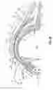 Fig. 08 - Method and apparatus for reducing intraocular pressure of an eye