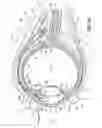 Fig. 09 - Method and apparatus for reducing intraocular pressure of an eye