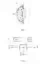 Fig. 02 - Intraocular pressure sensor with external pressure compensation
