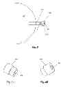 Fig. 04 - Intraocular pressure sensor with external pressure compensation