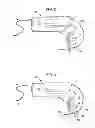 Fig. 03 - Interventional catheter housing assemblies incorporating guide wire brakes and management systems