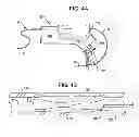 Fig. 04 - Interventional catheter housing assemblies incorporating guide wire brakes and management systems