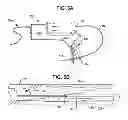 Fig. 05 - Interventional catheter housing assemblies incorporating guide wire brakes and management systems