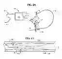 Fig. 06 - Interventional catheter housing assemblies incorporating guide wire brakes and management systems