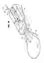 Fig. 09 - Interventional catheter housing assemblies incorporating guide wire brakes and management systems