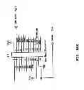 Fig. 83 - Vein scanner with user interface