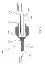 Fig. 02 - Method to secure an elastic component in a valve