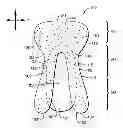 Fig. 01 - Body adhering absorbent article