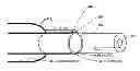 Fig. 01 - METHOD OF BACKFLOW REDUCTION DURING MATERIAL DELIVERY THROUGH A NEEDLE INTO TISSUE