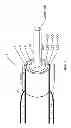 Fig. 02 - METHOD OF BACKFLOW REDUCTION DURING MATERIAL DELIVERY THROUGH A NEEDLE INTO TISSUE