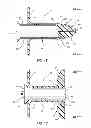 Fig. 03 - Extensible internal bolster for a medical device