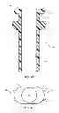 Fig. 06 - Extensible internal bolster for a medical device