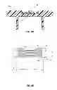 Fig. 11 - Extensible internal bolster for a medical device