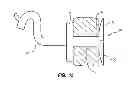 Fig. 18 - Extensible internal bolster for a medical device