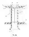 Fig. 20 - Extensible internal bolster for a medical device