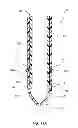 Fig. 21 - Extensible internal bolster for a medical device