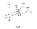 Fig. 07 - Apparatus and methods for accessing the lymphatic system