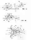Fig. 09 - Apparatus and methods for accessing the lymphatic system