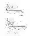 Fig. 12 - Apparatus and methods for accessing the lymphatic system