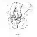Fig. 09 - Device and method of spacer and trial design during joint arthroplasty