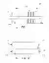 Fig. 02 - Balloon Catheter and Method of Use Thereof