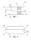 Fig. 02 - Balloon Catheter and Method of Use Thereof