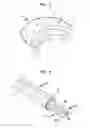 Fig. 02 - Apparatus and method for heart valve repair
