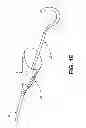 Fig. 06 - Intravascular blood filters and methods of use