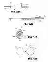 Fig. 33 - Intravascular blood filters and methods of use