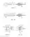 Fig. 07 - Embolic protection device