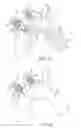 Fig. 09 - Embolic protection device