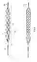 Fig. 02 - DESIGN AND METHODS FOR A DEVICE WITH BLOOD FLOW RESTRICTION FEATURE FOR EMBOLUS REMOVAL IN HUMAN VASCULATURE