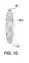 Fig. 06 - TISSUE PROTECTOR SUTURE CONSTRUCTS