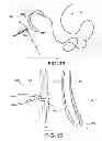 Fig. 09 - TISSUE PROTECTOR SUTURE CONSTRUCTS