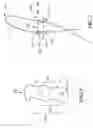 Fig. 02 - Flexible deformable suture anchor