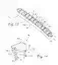 Fig. 08 - Dynamic compression plate