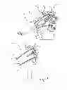 Fig. 02 - Periprosthetic plating system including plate with system for retaining tension on a cable