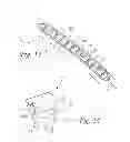 Fig. 08 - Periprosthetic plating system including plate with system for retaining tension on a cable