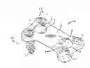 Fig. 01 - Bone screw retaining system