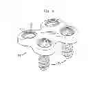 Fig. 06 - Bone screw retaining system