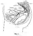 Fig. 02 - Devices and methods for stimulating nerves