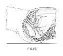 Fig. 45 - Devices and methods for stimulating nerves