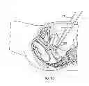 Fig. 49 - Devices and methods for stimulating nerves