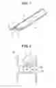 Fig. 02 - Red Light Implant for Treating the Spine