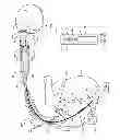 Fig. 06 - Header block for an AIMD with an abandoned lead connector cavity