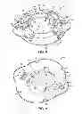 Fig. 07 - Burr hole plug having sidable clamping mechanism