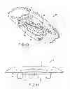 Fig. 08 - Burr hole plug having sidable clamping mechanism