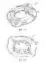 Fig. 09 - Burr hole plug having sidable clamping mechanism