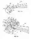 Fig. 43 - Burr hole plug having sidable clamping mechanism