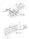 Fig. 44 - Burr hole plug having sidable clamping mechanism